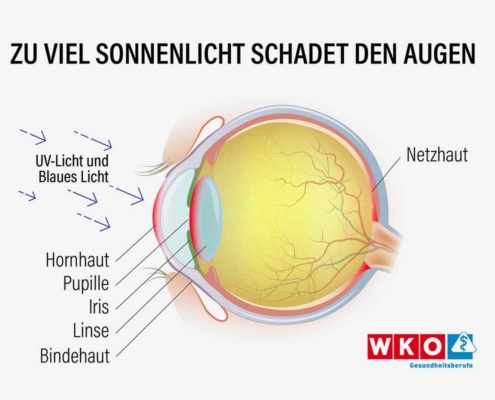 Niemals oben ohne in die Sonne: So reagieren Augen auf UV-Strahlen